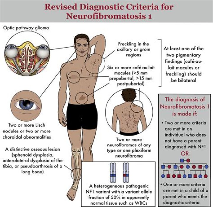 Are there prenatal tests for neurofibromatosis?