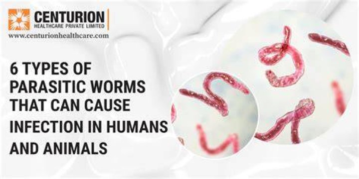 Are there really worms in hot dogs?