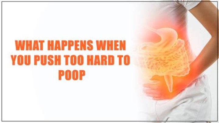 Are you supposed to push to poop?
