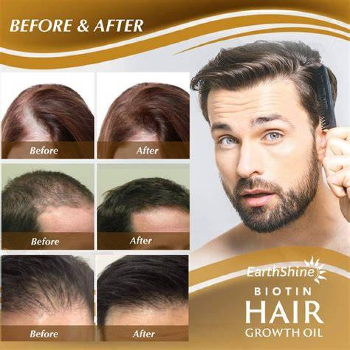 Can biotin regrow hair?