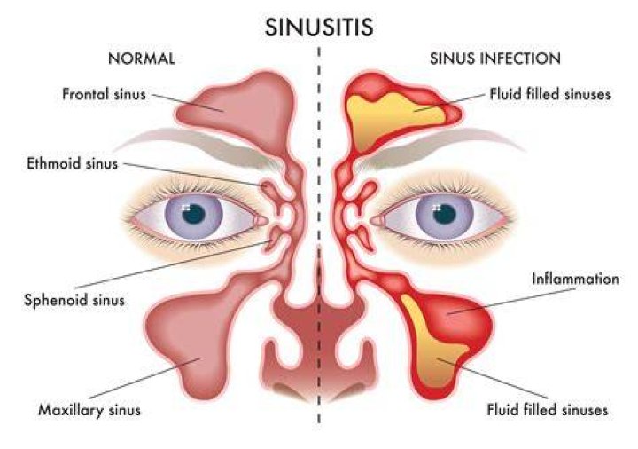 Can blocked nose cause low oxygen levels?