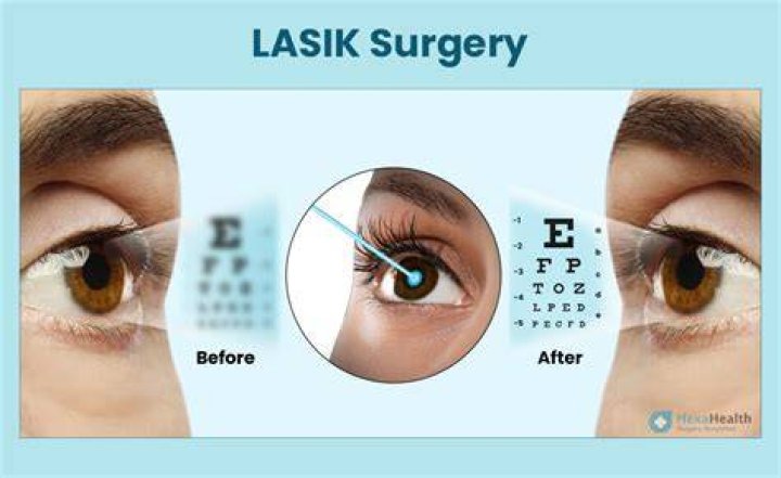 Can I look at my phone after LASIK?
