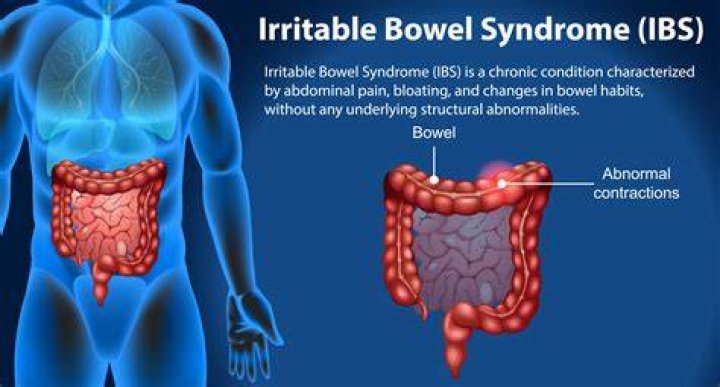 Can IBS lead to gastroparesis?