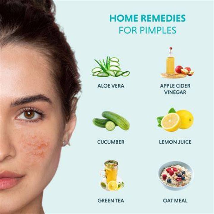 Can Kojic remove pimples?