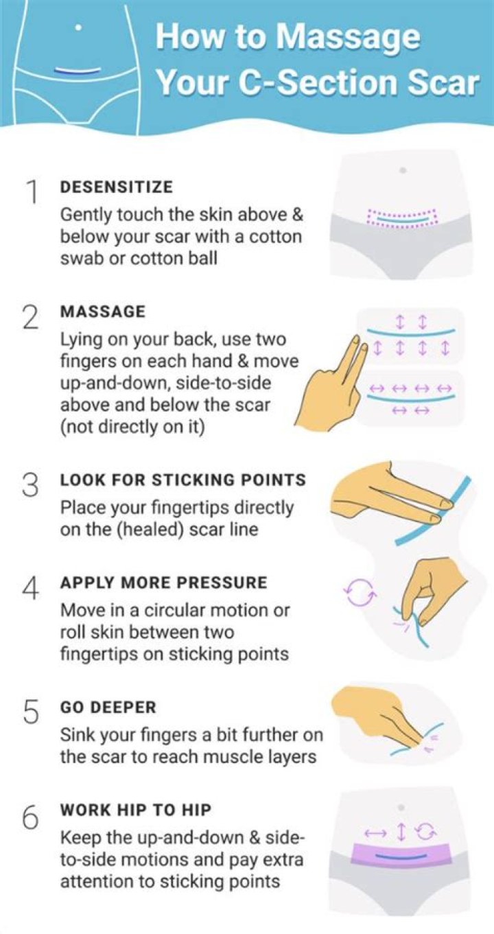 Can massaging a scar make it worse?