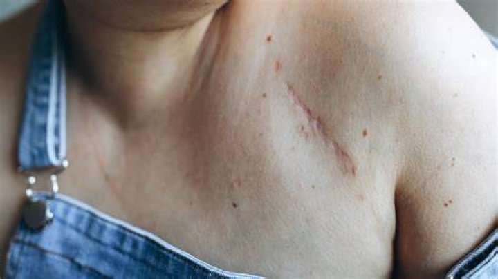 Can whips leave scars?