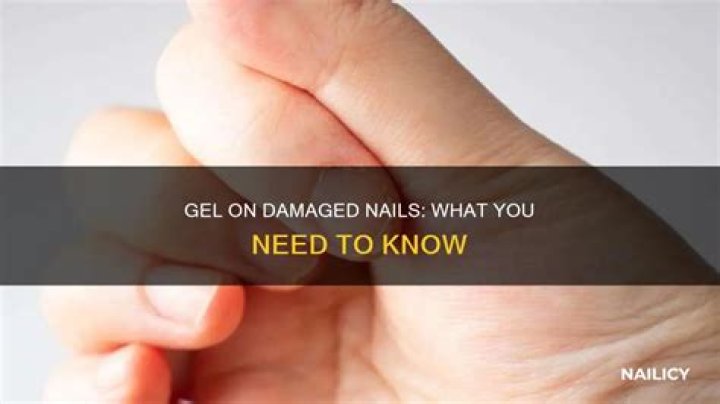 Can you put gel on damaged nails?