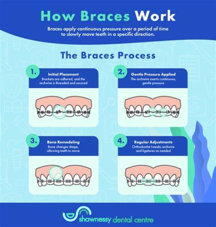 Do braces work faster when pregnant?