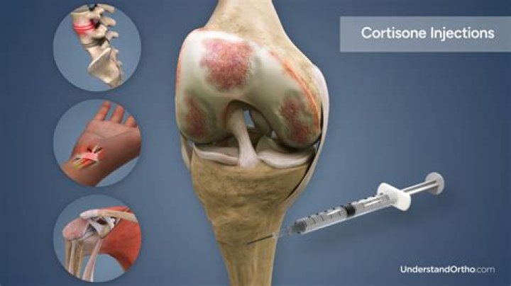 Do filling injections hurt?