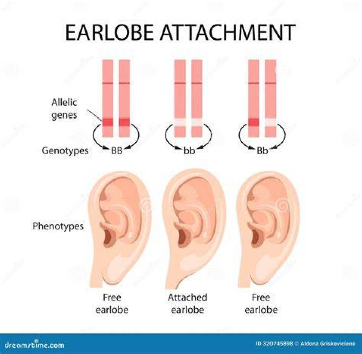 Do your earlobes sag?