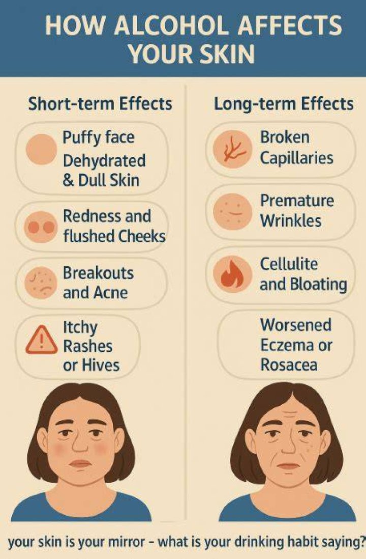 Does alcohol affect eczema?