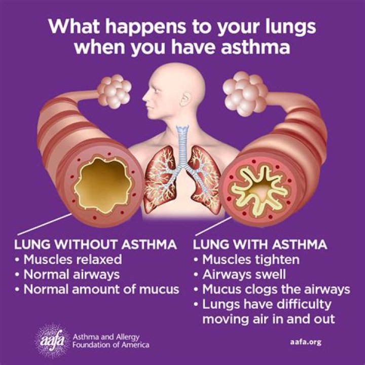 Does breathing cold air help asthma?