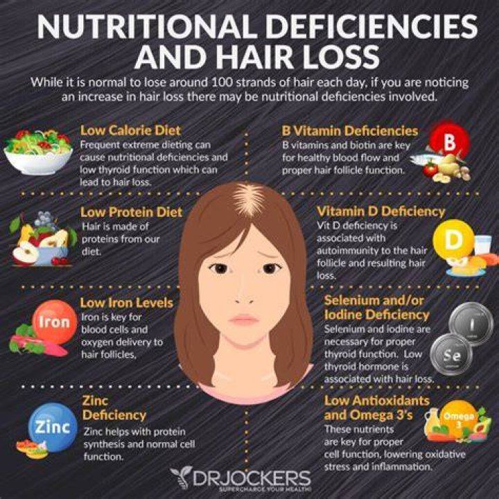 Does dairy cause hair loss?