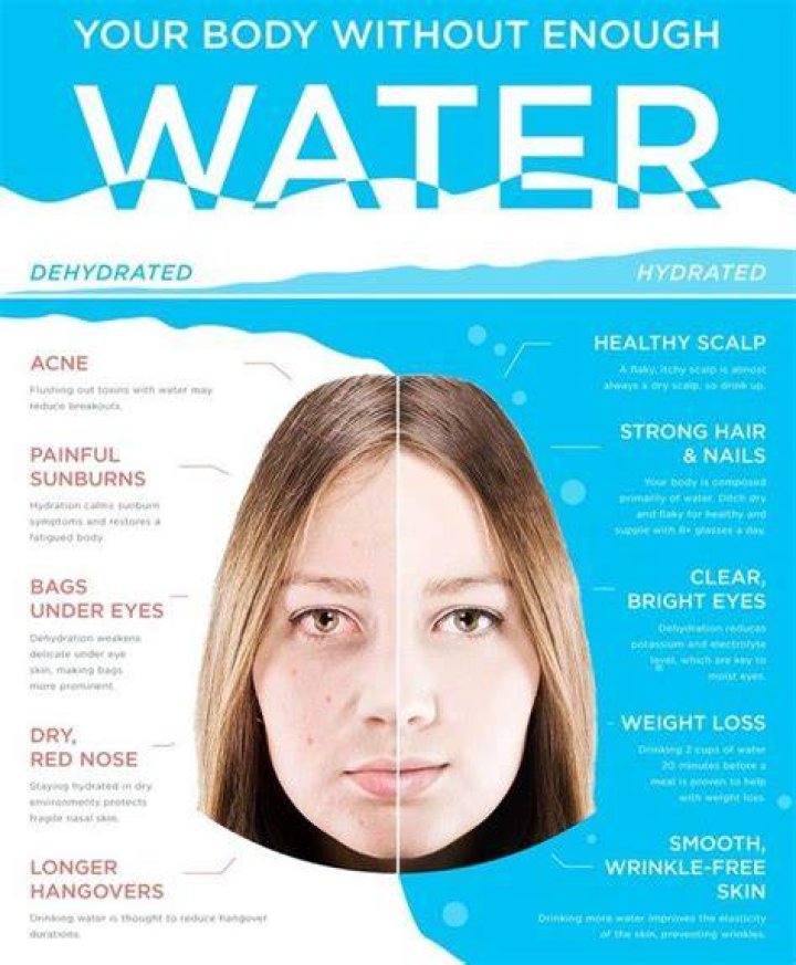 Does drinking water clear up your skin?