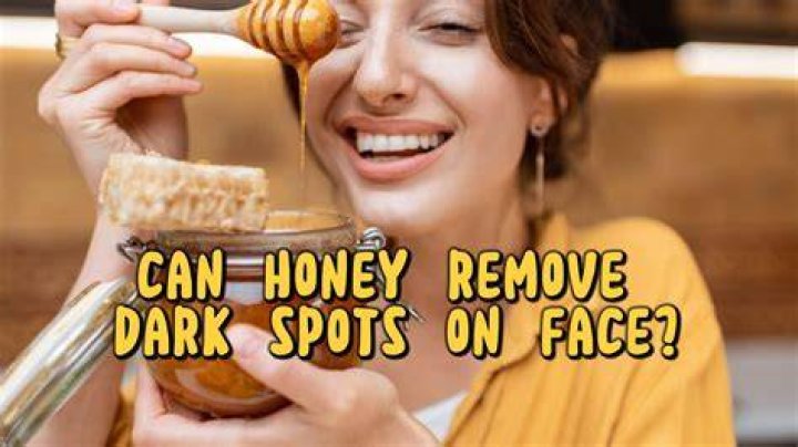 Does honey remove dark spots?