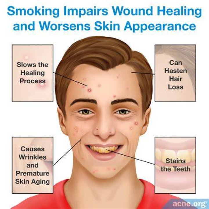 Does nicotine affect skin?