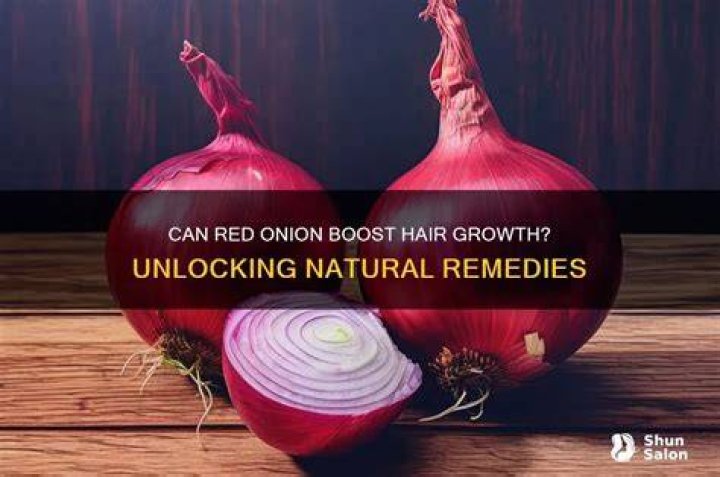 Does red onion grow hair?