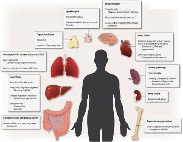 Does sepsis damage the liver?