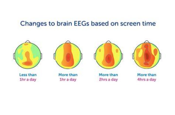 Does TV affect babies brain development?