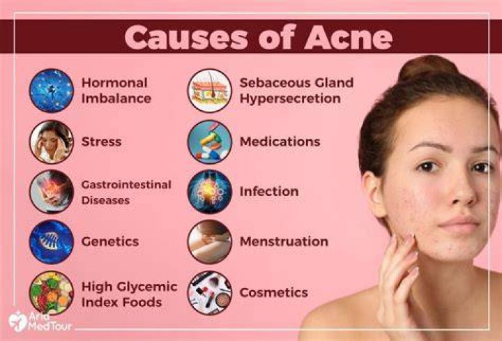 Does vitamin E cause acne?