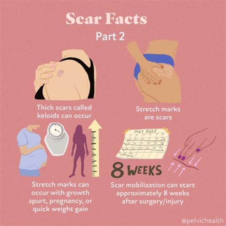 How do I know what kind of scar I have?