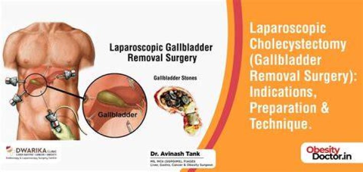 How do you know when you need your gallbladder removed?
