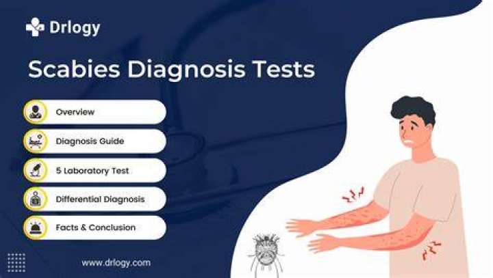 How do you test for scabies?