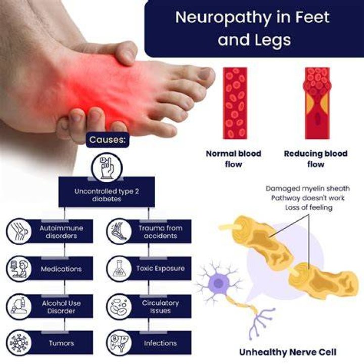 How do you treat nerve damage in the foot?