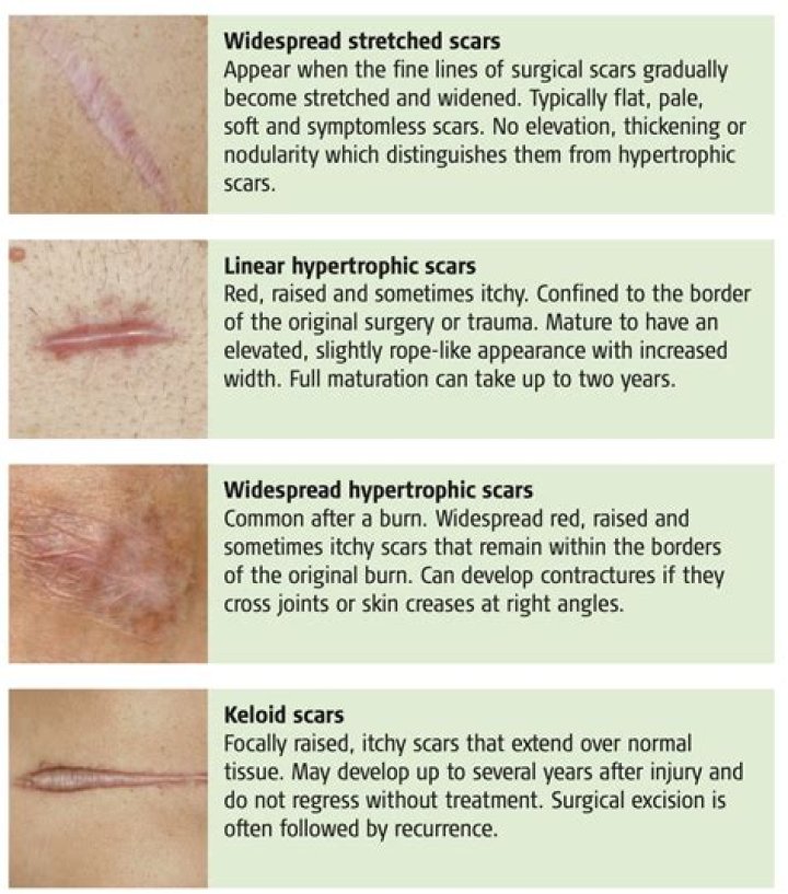 How long should a scar hurt after surgery?