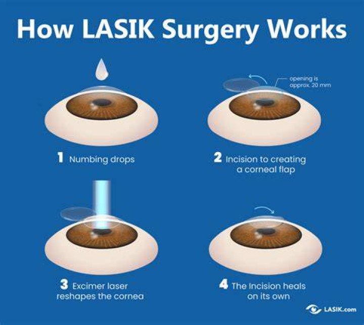 How many days should I rest after LASIK?