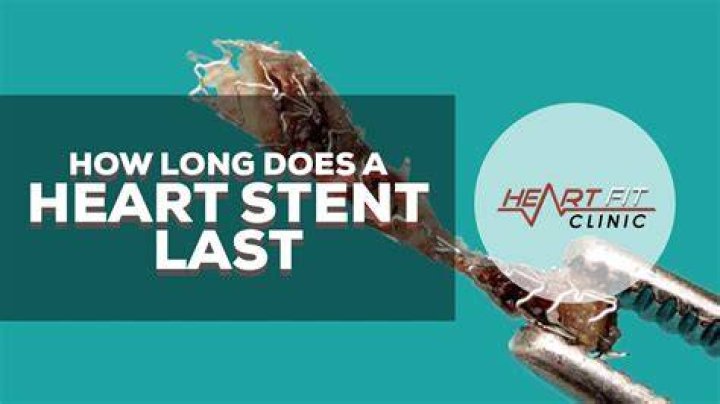 How many years does a stent last?