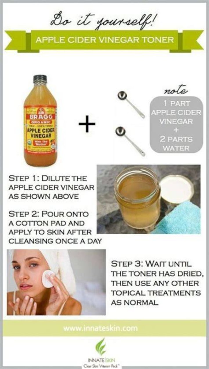 How often can I use apple cider vinegar on my face?
