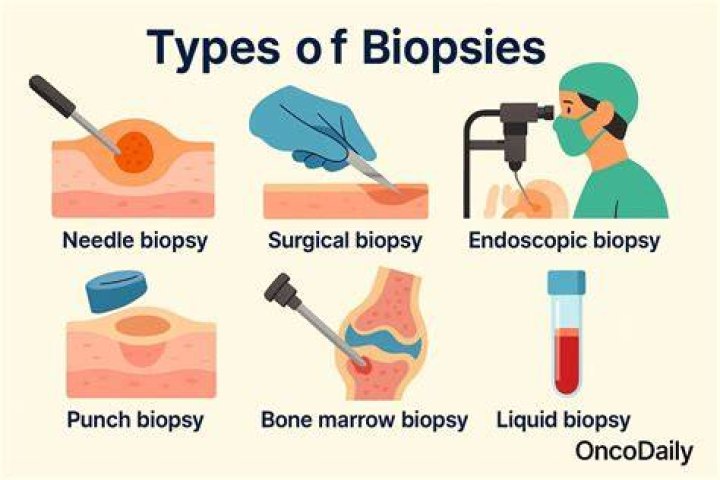 Is a biopsy considered surgery?