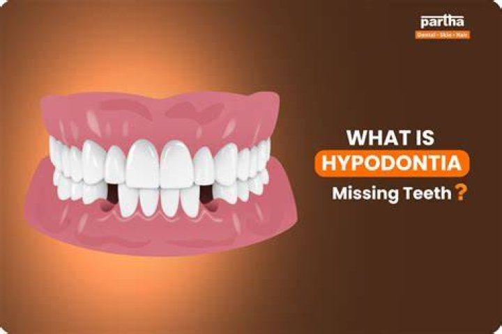 Is hypodontia a diagnosis?