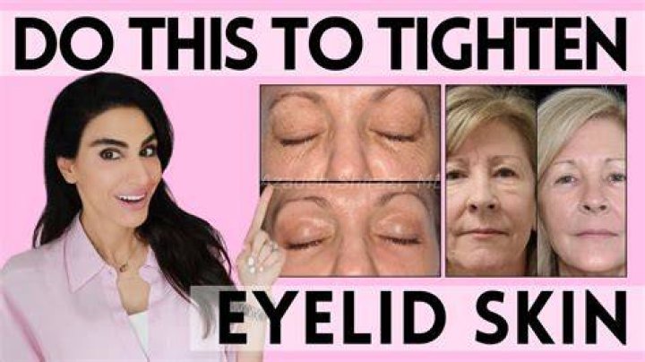Is it possible to tighten eyelid skin?