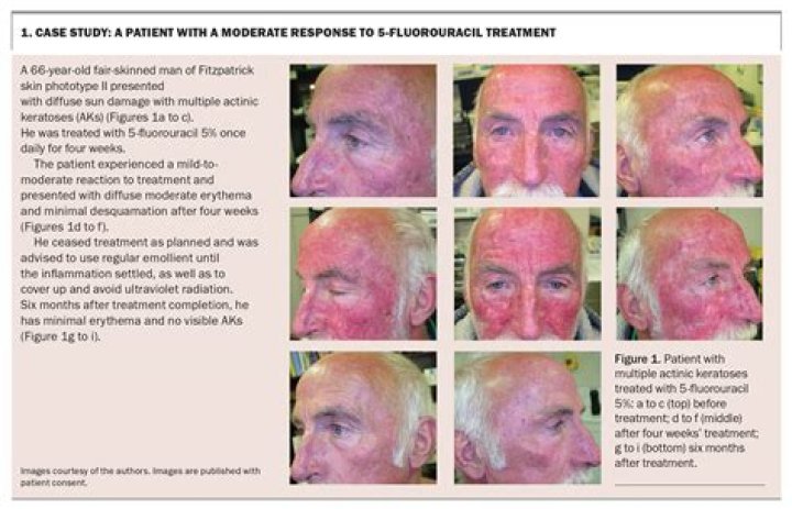 Is taking pictures of patients illegal?