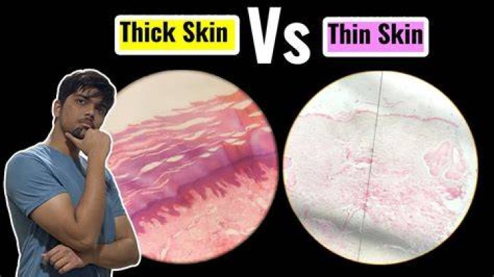 Is thin or thick skin better?