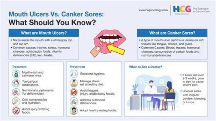 Should I worry about canker sores?