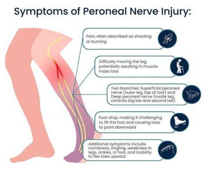 What are the symptoms of nerve damage in your leg?