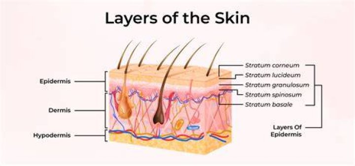 What are the two layers of a cast?