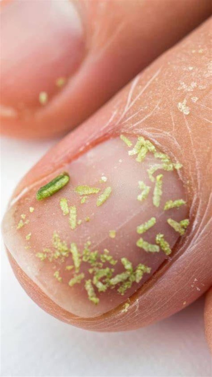 What bacteria is found under fingernails?