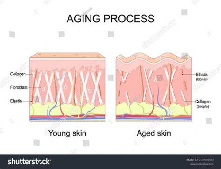 What causes loss of collagen?