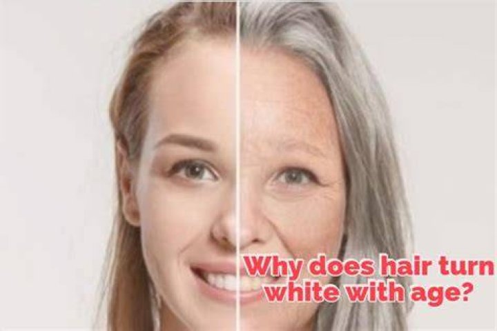 What color hair turns white with age?