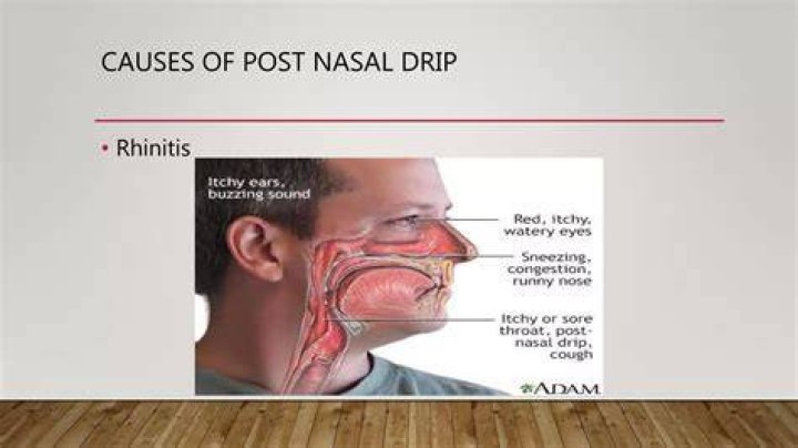 What does it mean if you have constant post-nasal drip?