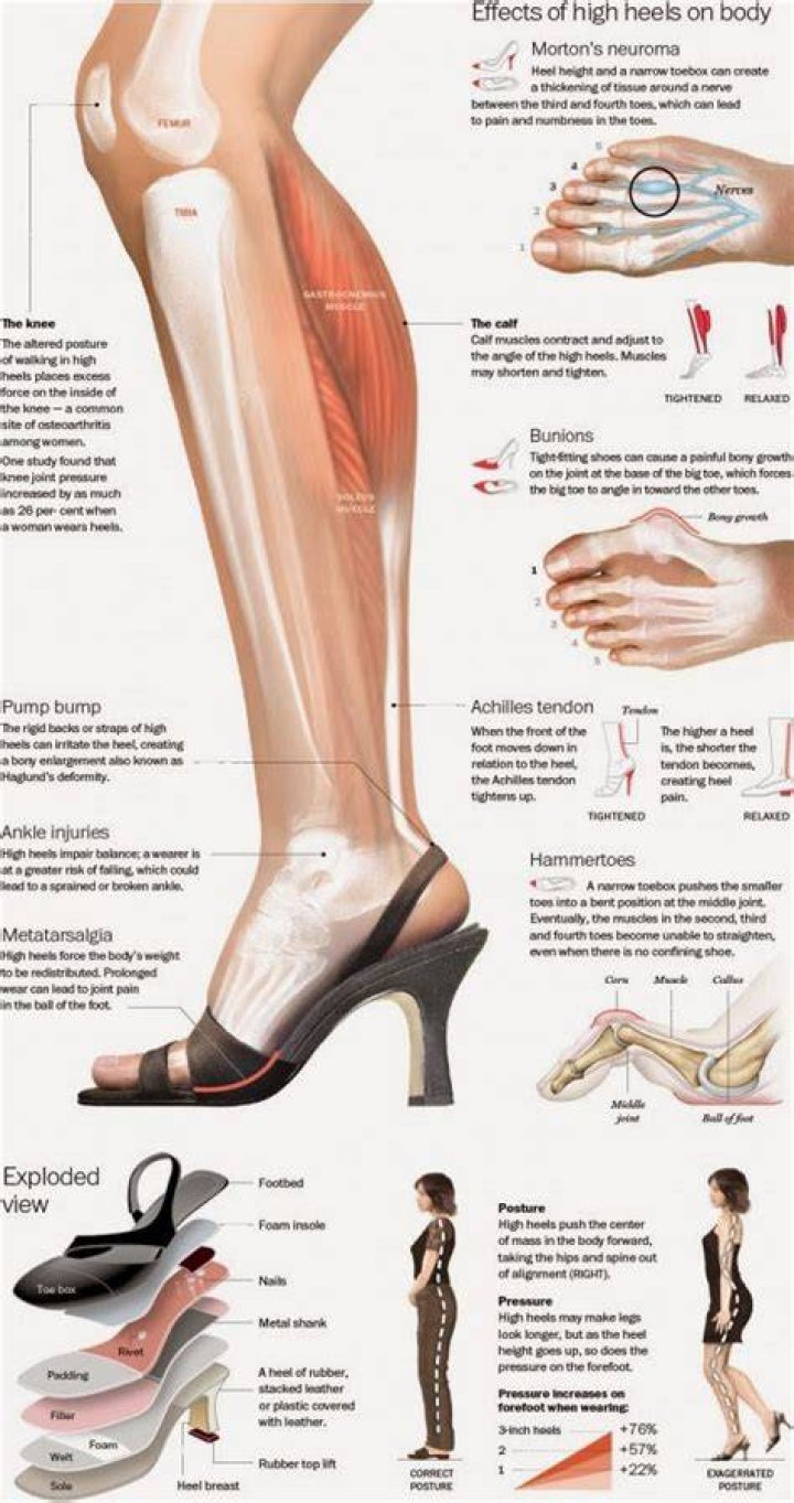What happens if you wear heels everyday?