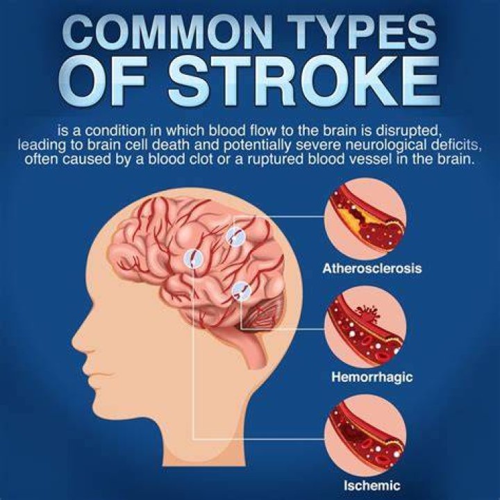 What is a devastating stroke?