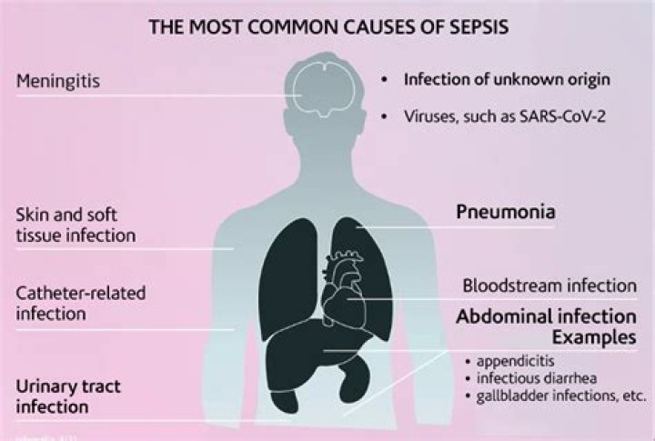 What is the most common cause of sepsis?