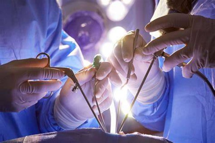 What is the most complicated surgery?