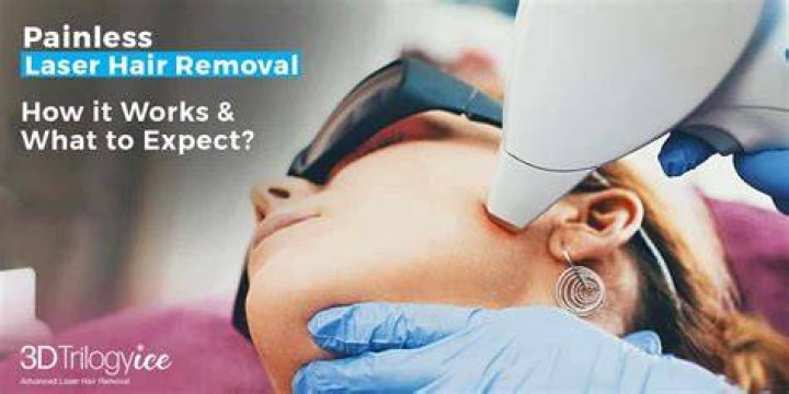 What is the most painless laser hair removal?
