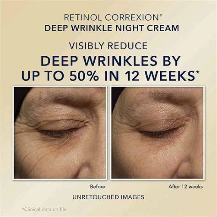 What percentage of retinol is in RoC Deep Wrinkle serum?